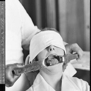 Frank Carberry, dental surgeon, demonstrates a partial ...